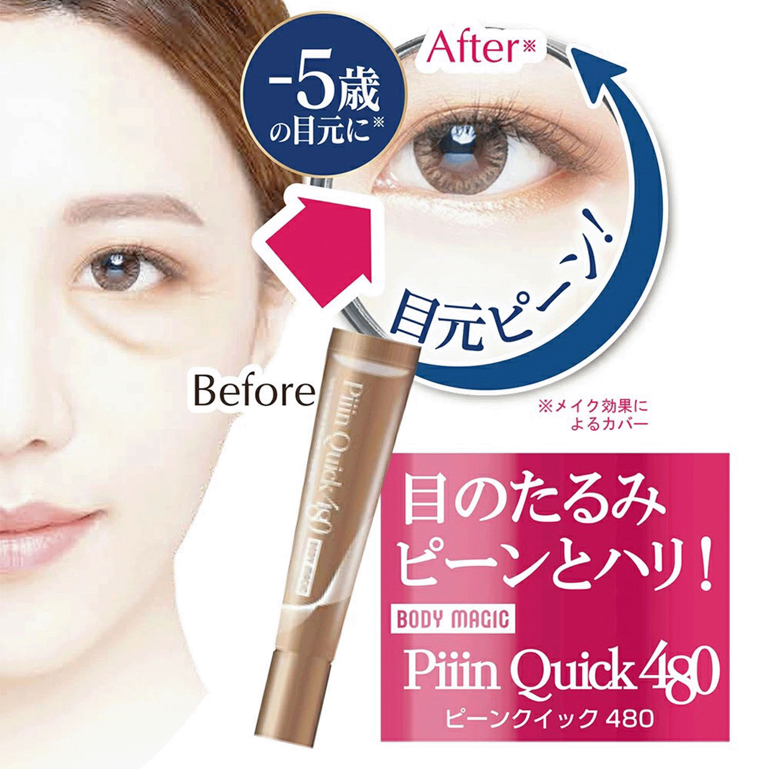 目のたるみピーンとハリ！ ピーンクイック - 画像1