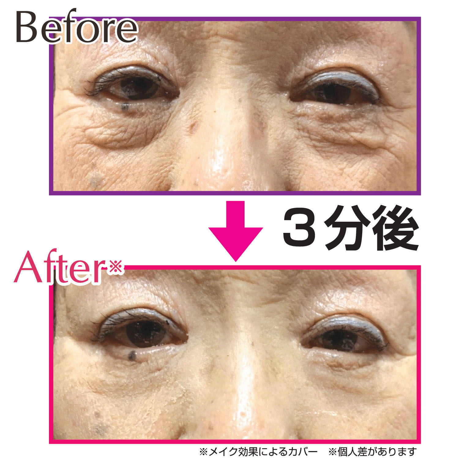 目のたるみピーンとハリ！ ピーンクイック - 画像4